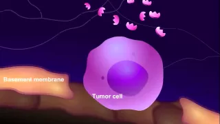 Introduction to Cancer Biology (Part 3): Tissue Invasion and Metastasis
