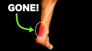 The Secret to Fix Achilles Tendonitis FAST