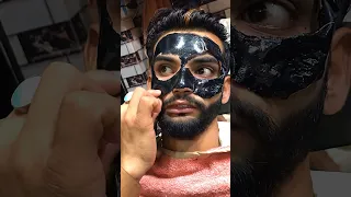 How to use charcoal face mask remove blackheads #shot #shot #viral