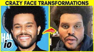 Top 10 Craziest Celebrity Face Transformations