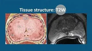 Multiparametric MRI to Detect Clinically Significant Prostate Cancer: What Urologists Need to Know