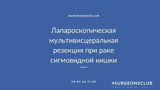 Лапароскопическая мультивисцеральная резекция при местно-распространенном раке сигмовидной кишки