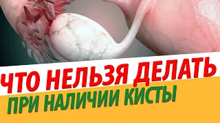 ЧТО НЕЛЬЗЯ ДЕЛАТЬ , имея кисту яичника❓❓❓