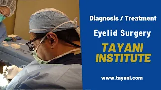 Before and After Care of Eyelid Surgery | Tayani Institute