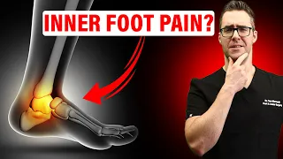 Posterior Tibial Tendonitis Treatment [FIX Inside of the Ankle Pain!]