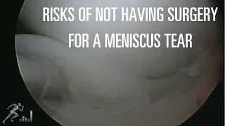 Risk of not having surgery for a meniscus tear