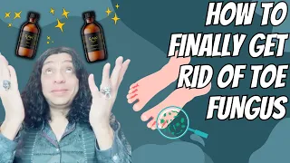 🦠🦶YOUR TOE FUNGUS WON'T COME BACK AFTER THIS!🦶🦠