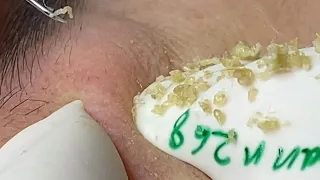 Satisfying With Loan Nguyen Spa Video #056