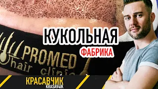 Где я сделал пересадку волос и почему никому не рекомендую? (ПромедPromed Clinic)  Красавчик