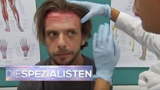 Schwerwiegende Folgen nach Haartransplantation | Auf Streife - Die Spezialisten | SAT.1 TV