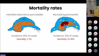 RVH Medical Grand Rounds: Acute Pancreatitis - From diagnosis to discharge