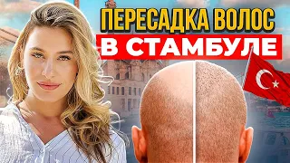 ПЕРЕСАДКА ВОЛОС В СТАМБУЛЕ 2023. СКОЛЬКО СТОИТ? СТОИТ ЛИ ЭТО ДЕЛАТЬ? ПЛАСТИЧЕСКАЯ ХИРУРГИЯ В ТУРЦИИ