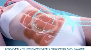 Emsculpt механизм действия [OGCclinic - клиника Доктора Горчаковой]