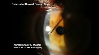 Corneal FB