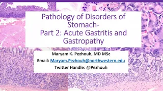 Part 2- Pathology of Gastric Disorders- Active gastritis-Maryam Pezhouh, MD MSc