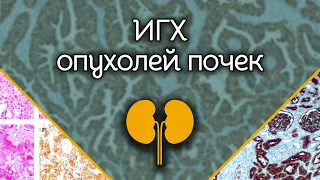 ДЕМО ИГХ опухолей почек | Лекции по патологической анатомии