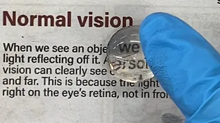 Dissection of Ox Eye