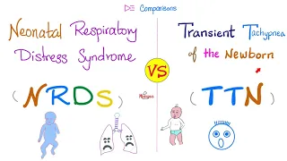 Neonatal Respirtory Distress Syndrome (NRDS) vs Transient Tachypnea of the Newborn (TTN)