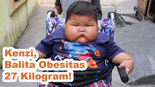 Kenzi, Balita Obesitas 27 Kilogram Diberi Susu Kental Manis!