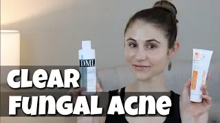 SKIN CARE PRODUCTS TO CLEAR FUNGAL ACNE| DR DRAY