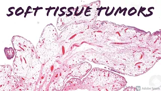 Soft Tissue Pathology (epithelioid fibrous histiocytoma ALK-1, atypical FH, paraganglioma, and more)