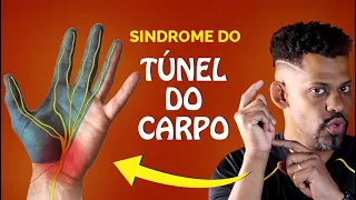 Melhore a SÍNDROME DO TÚNEL DO CARPO com esses exercícios de Mobilidade Neural