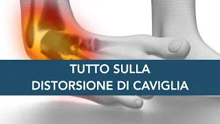 DISTORSIONE DI CAVIGLIA: tutto quello che devi sapere