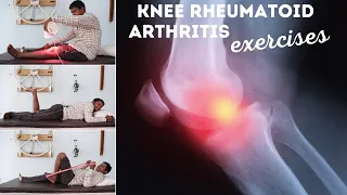 9 Best Knee Rheumatoid Arthritis Exercises| Prevent Knee Stiffness, Pain