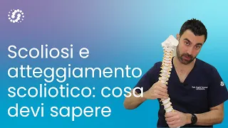 Scoliosi e atteggiamento scoliotico: cosa devi sapere