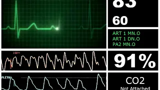 Hospital Monitor with FlatLine (L) (SD)