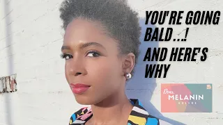 Black Women are Going Bald...! and here's why  JOSHICA BEAUTY