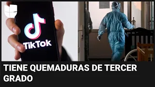 Niño hispano queda con graves quemaduras al hacer peligroso reto en TikTok