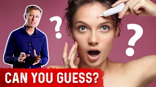 How To Get Rid of Acne? – The Biggest Mistake in Acne Treatment – Dr. Berg