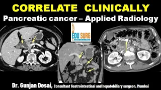 Applied radiology - pancreatic CT reading on console - Correlate clinically, CT scan of the pancreas