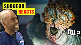 Could The Last Of Us Happen IRL? Surgeon Reacts To Cordyceps Infection & Zombie Fungus