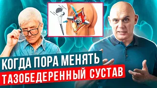 🦵 Когда нужно менять тазобедренный сустав, подготовка к операции. Тазобедренный сустав менять.