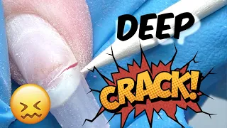 How to Repair Deep Nail Crack