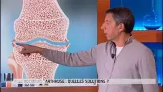 Qu'est-ce que l'arthrose ? - Allô Docteurs