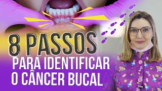 8 Passos para identificar o Câncer Bucal (com Dra. Aline Manfro)