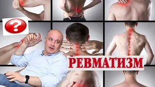 РЕВМАТИЗМ. Острая ревматическая лихорадка. Во всём виновато горло?