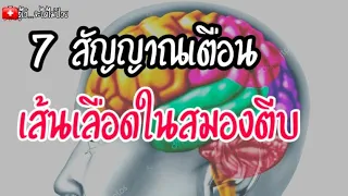 🎯 7 สัญญาณเตือนเส้นเลือดในสมองตีบ |รู้ไว้จะได้ไม่ป่วย|เส้นเลือดในสมองตีบ|อัมพฤกษ์|อัมพาต