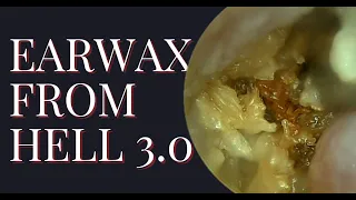 Earwax From HELL 3.0