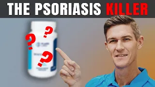 Best Supplement for Psoriasis Treatment | How to Get Rid of Psoriasis Naturally