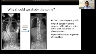 BRAINterns 7/10 - Med Student Spine Neuroanatomy with Dr. Mishra