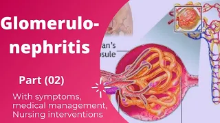 Glomerulonephritis in Urdu and Hindi || part 02 || sign & symptoms, medical & Nursing management,