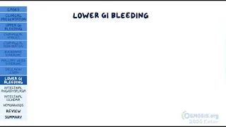 Gastrointestinal Bleeding : Clinical Practice | Osmosis