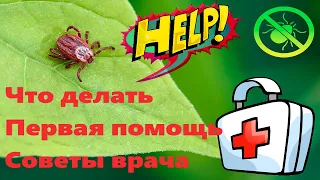 ОСТОРОЖНО КЛЕЩИ: Укус человека и собаки | Первая помощь