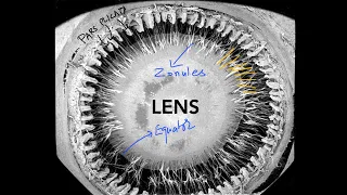 Lens - Part 1: Anatomy, Physiology and Biochemistry