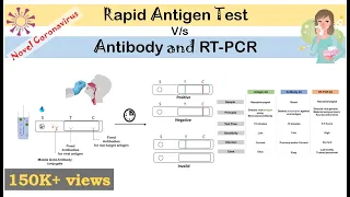 Rapid Antigen Test for Covid-19 (Novel coronavirus). Principle, How it works?