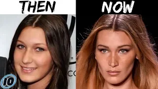 Top 10 Influencers Who Claim They Haven't Had Plastic Surgery